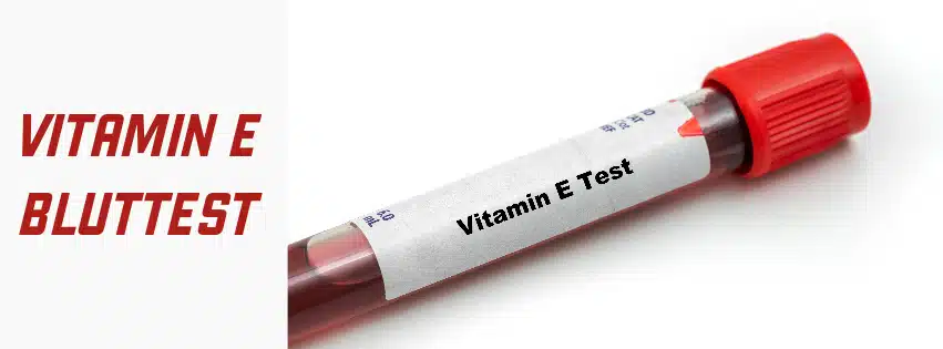 Vitamin E Bluttest